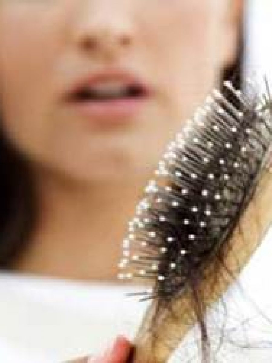hair-loss2